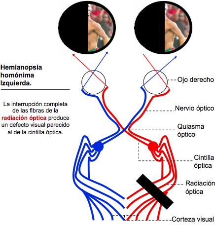 Campimetria
